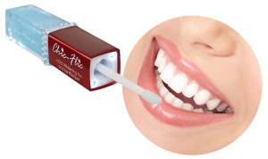 Wzrost popularności domowego wybielania zębów żelem dentystycznym Wzrost popularności domowego wybielania zębów żelem dentystycznym